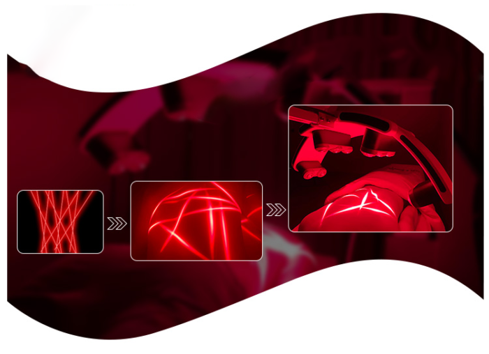 BieBar BieLipoliz | Türkiye' de ve Dünya' da ilk Ice EMS - Görsel 11